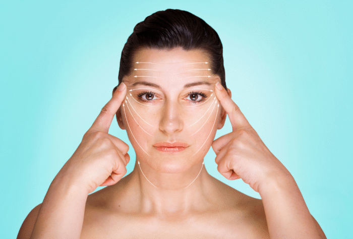 Face and Neck lift