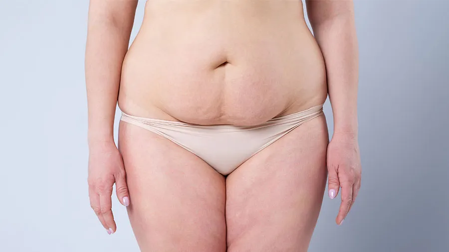 karın germe ameliyatı