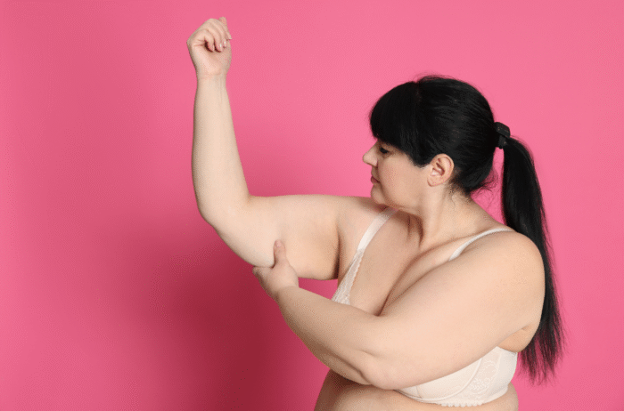 Arm Lift