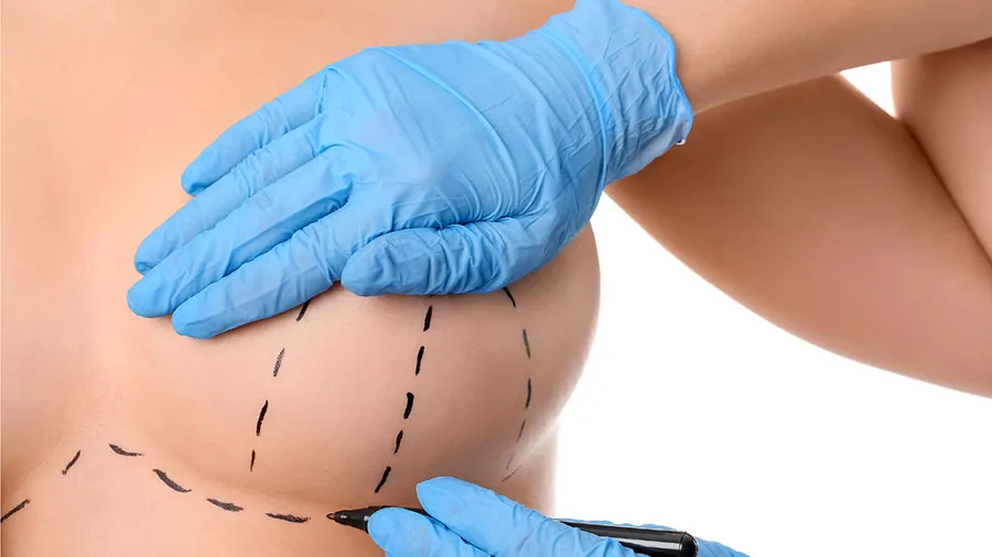 meme dikleştirme ameliyatı