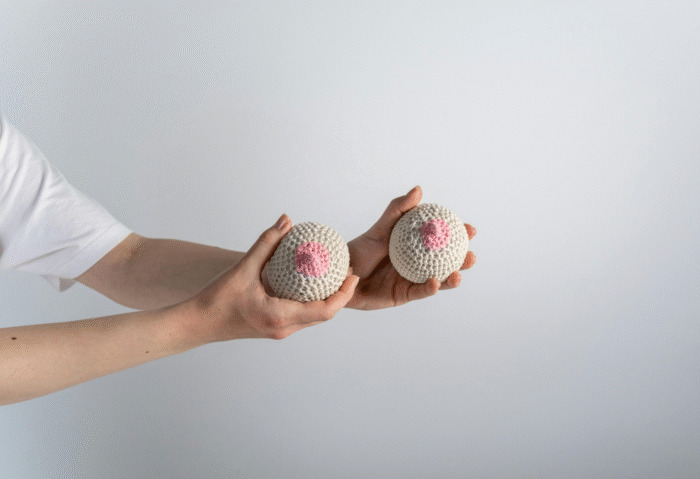 Breast Lifting and Enlargement (Augmentation Mastopexy)