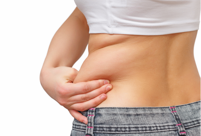 Liposuction