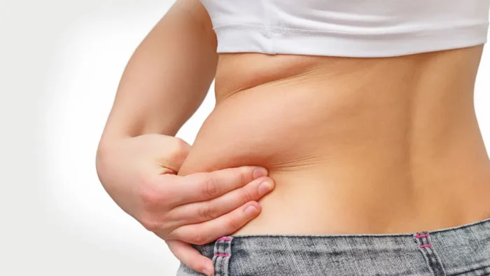 Liposuction (Yağ Aldırma)