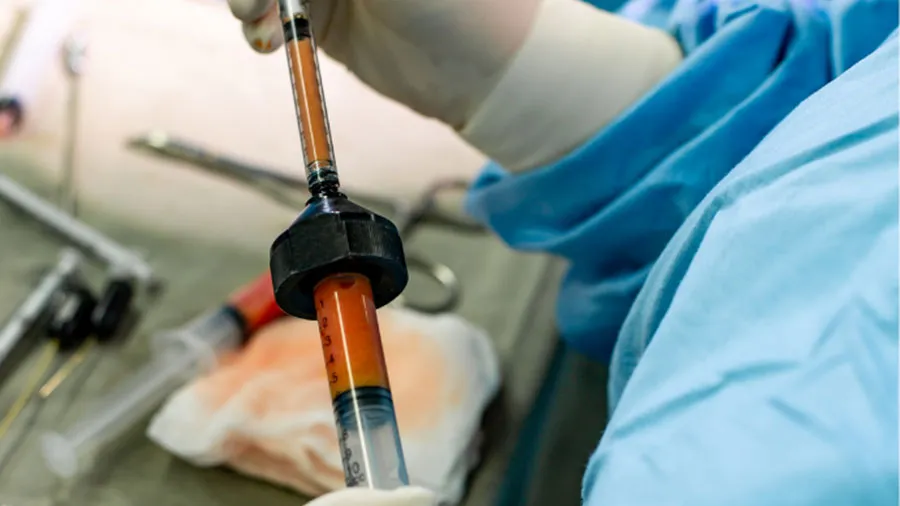 yüze yağ enjeksiyonu yağ transferi