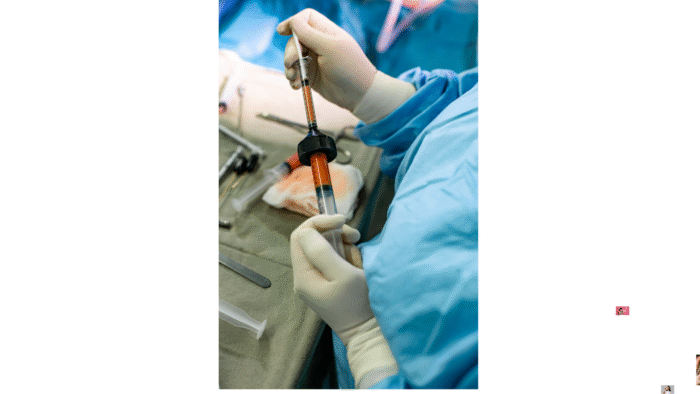 Facial Fat Injection (Fat Transfer)