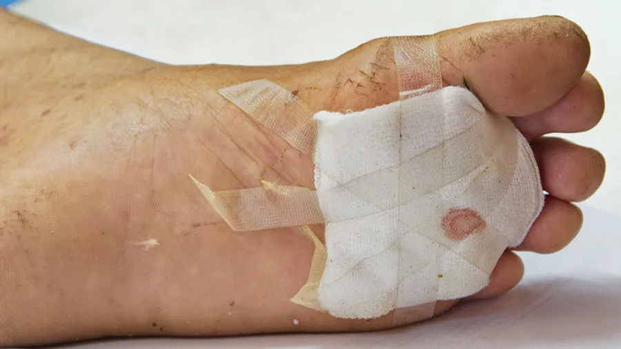 doku nakilleri ve flep cerrahisi