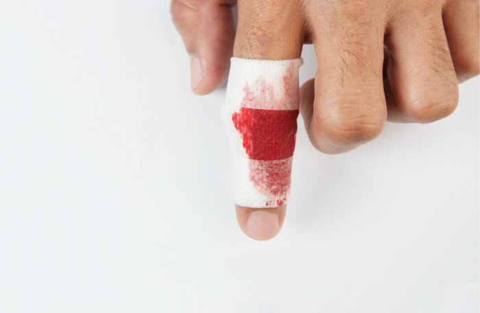 Hand Surgery – Microsurgery