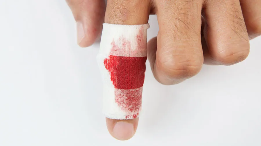 el cerrahisi mikrocerrahi