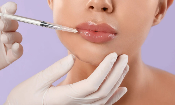 Filler applications