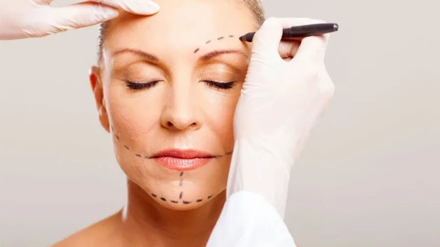 yüz germe ameliyatı kaç yaşında yapılır