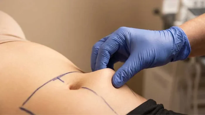 Liposuction Sonrası Kilo Alırsam Ne Olur?