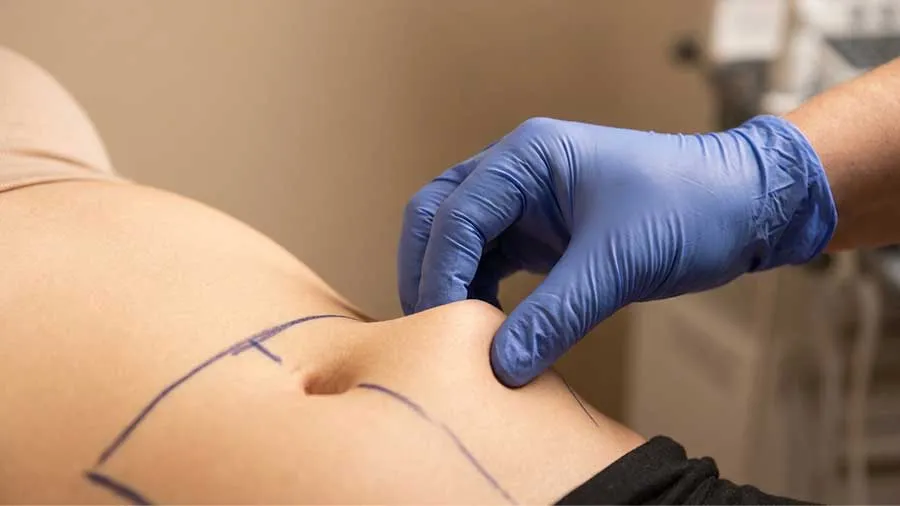 Liposuction Sonrası Kilo Almak